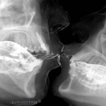 рентгеновский снимок поцелуя…