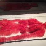 Это кровеносные сосуды реального человека, который пожертвовал своё тело для научных целей